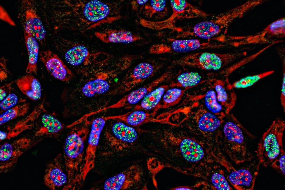Flow Cytometry Gating: Everything You Need to Know